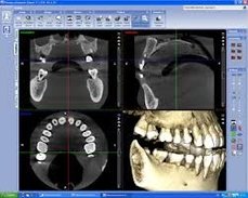 3D rentgen